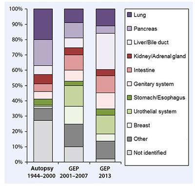 Does Cancer of Unknown Primary (CUP) Truly Exist as a Distinct Cancer Entity?